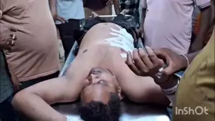 मेदिनीनगर (डालटनगंज): चैनपुर के पास सड़क दुर्घटना में रतनलाल ऑटो बाइक्स शोरूम का कर्मचारी घायल, पेट में घुसा कांच