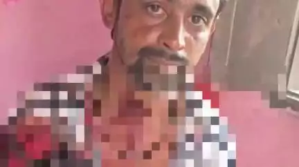 अमरोहा: अमरोहा में दामाद पर कहर, मौहल्ला अफगानान में ससुराल वालों ने बंधक बनाकर जमकर पीटा, बामुश्किल बची जान