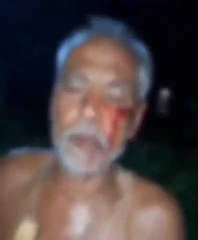 नौगढ़: छितरापार में कुछ लोगों ने मिलकर एक बुजुर्ग को मारपीट कर किया घायल, पुलिस ने कार्रवाई शुरू की
