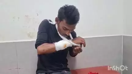 मुंगेर: युवक के हाथ में लगी गोली, परिजनों ने सदर अस्पताल में कराया भर्ती, पुलिस जांच में जुटी