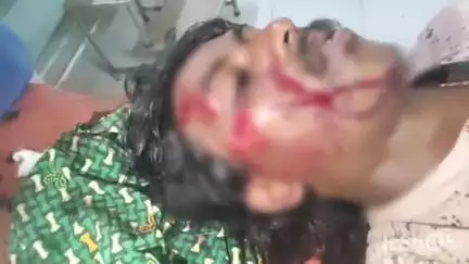 ఆదోని: మద్యం మత్తులో  ద్విచక్ర వాహనం పై నుండి కింద పడి యువకుడికి గాయాలు