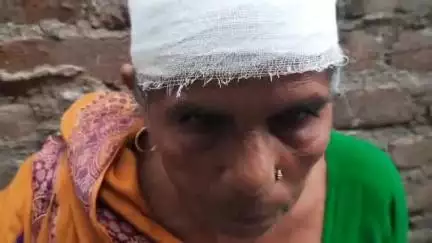 बलिया: परवल टोला वार्ड संख्या 10 में एक महिला के साथ मारपीट, सिर फोड़ा