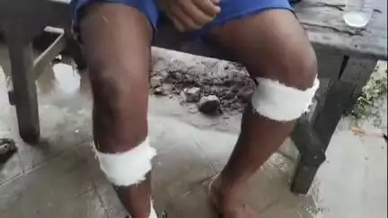 স্বরূপনগর: সাড়াপুল পাখির মোড এলাকায় দুর্ঘটনায় গুরুতর আহত চার ,ঘটনাস্থলে পুলিশ -আটক দুটি বাইক