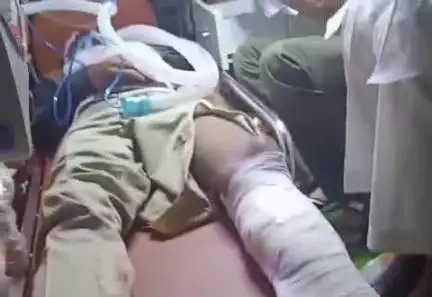 नारासन: जौरासी जबरदस्तपुर में मुस्लिम समाज के 2 पक्षों के बीच हुआ खूनी संघर्ष, कुल्हाड़ी से की एक व्यक्ति की हत्या