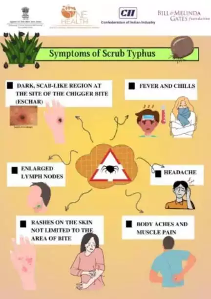 🤒 Beware of scrub typhus symptoms! 🦠 Check out this informative infographic highlighting the key symptoms of scrub typhus, a potentially serious disease. Early detection is key! 🕵️‍♂️💊 #OneHealthIndia #OneHealth